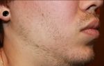 Что делать, если борода растет неравномерно